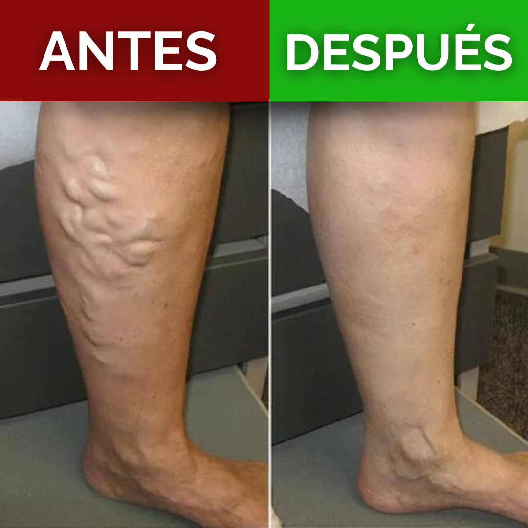 Tapete Masajeador para Pies EMS-RelaxFoot